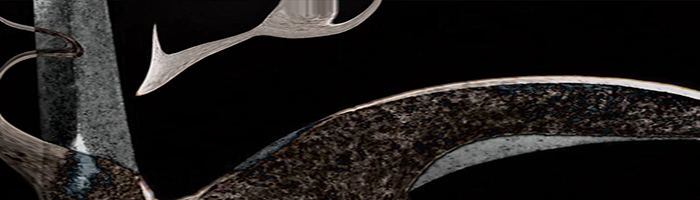 portion of the artwork for Michelle Ross's stories